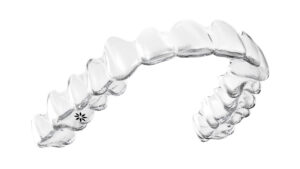 Clear Invisalign aligners used to discreetly straighten teeth and improve smile alignment