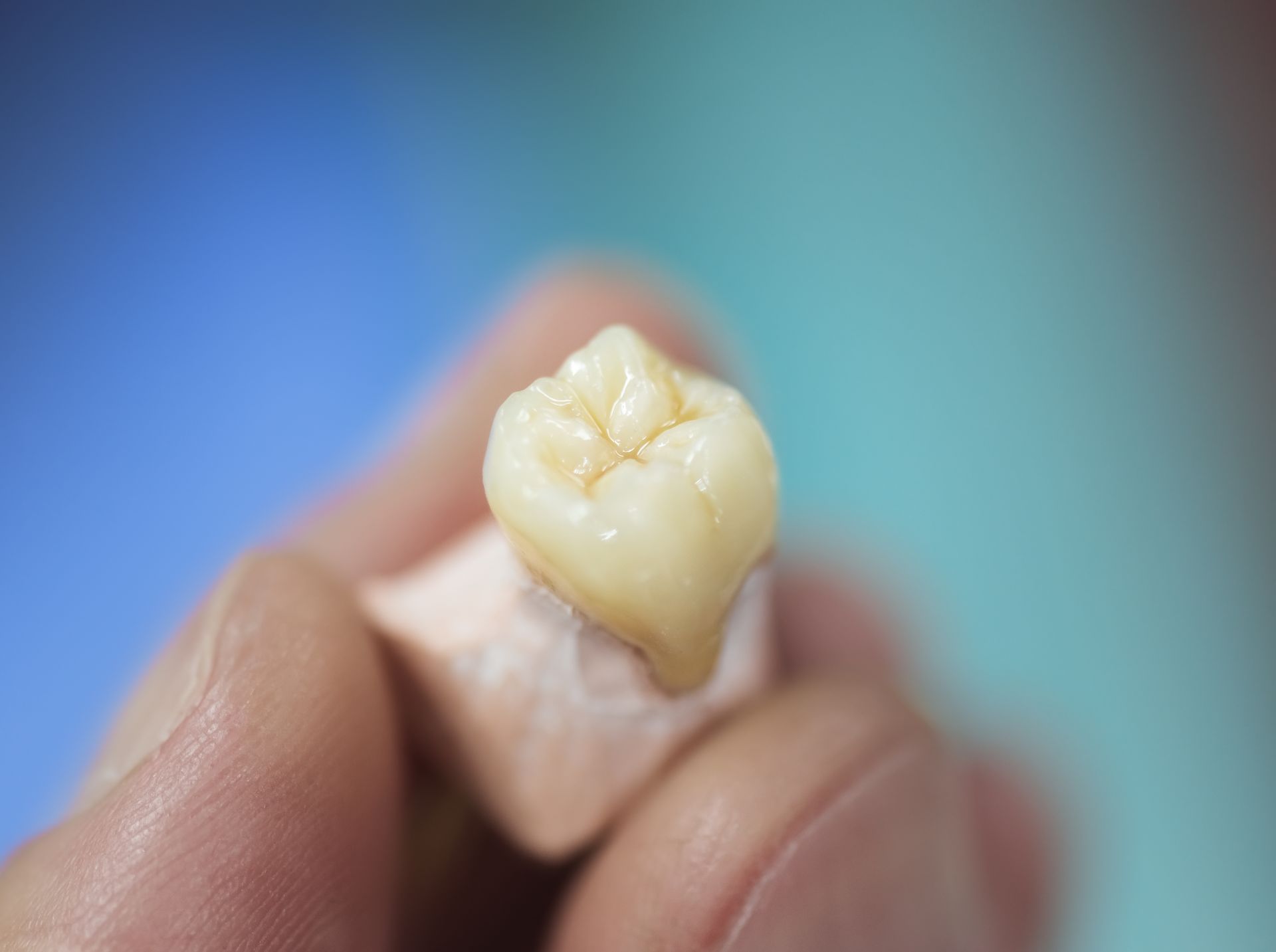 Dental crown being held for restorative tooth treatment